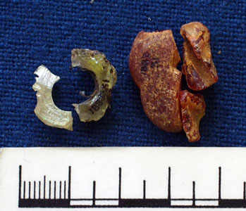 Beads (AN1883.31b)